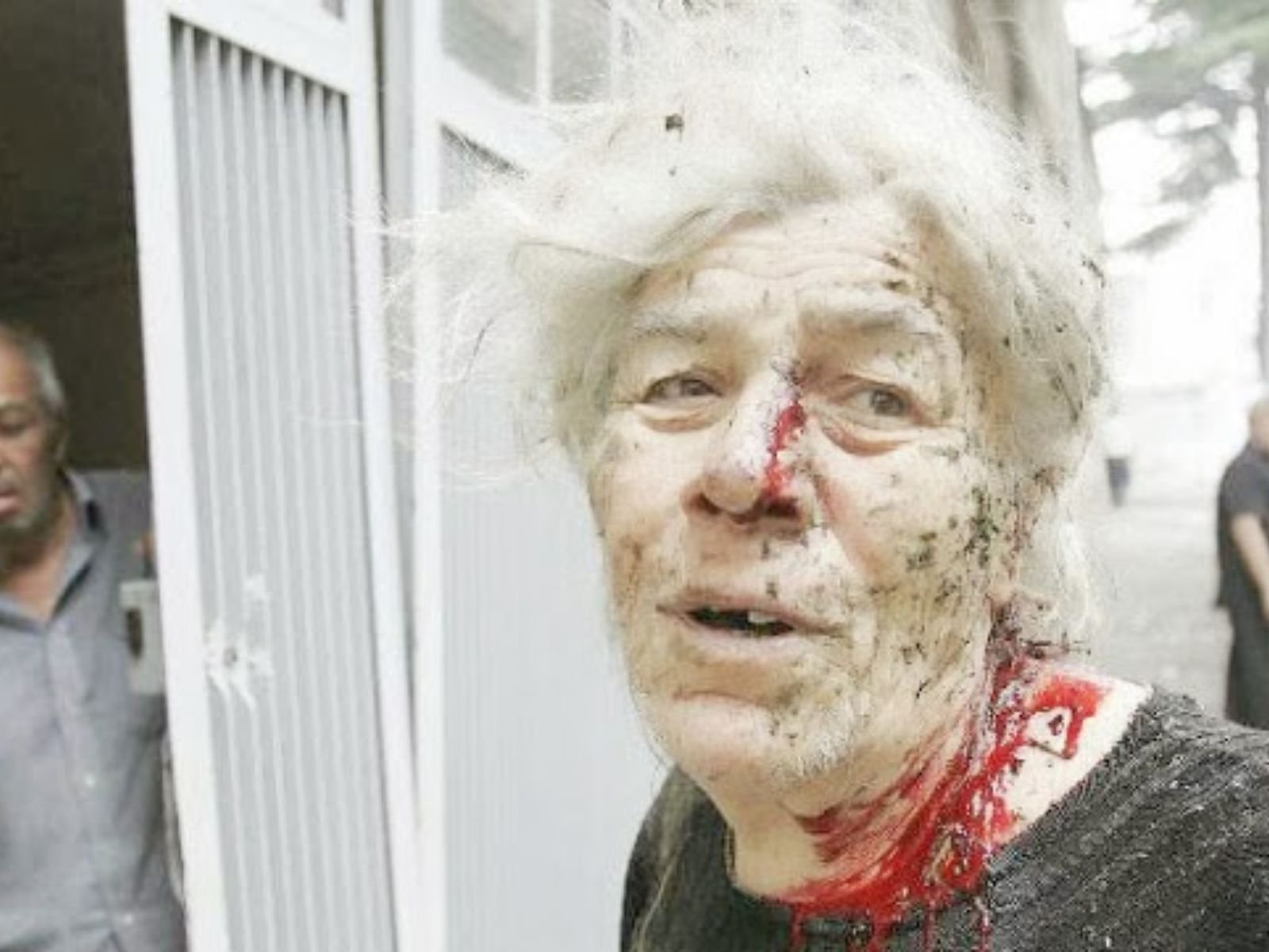 Mulher georgiana ferida após bombardeios na cidade de Gori, Geórgia, durante a Guerra dos Cinco Dias. Foto: Davi Mdzinarishvilli/Reuters